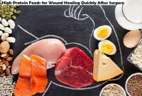 High Protein Foods for Wound Healing Quickly After Surgery