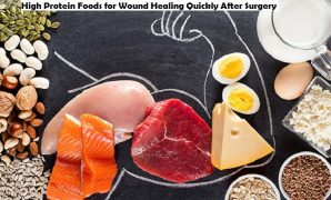 High Protein Foods for Wound Healing Quickly After Surgery