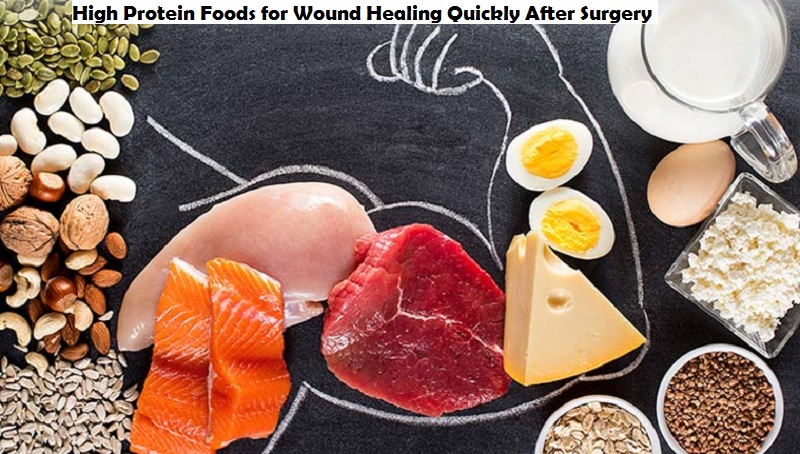 High Protein Foods for Wound Healing Quickly After Surgery